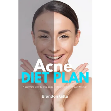 Acne Diet Plan: A Beginner's Step-by-Step Guide to Managing Acne Through Nutrition With Curated Recipes and a Sample Meal Plan