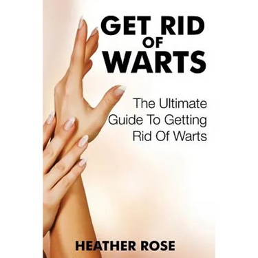 Get Rid of Warts: The Ultimate Guide to Getting Rid of Warts
