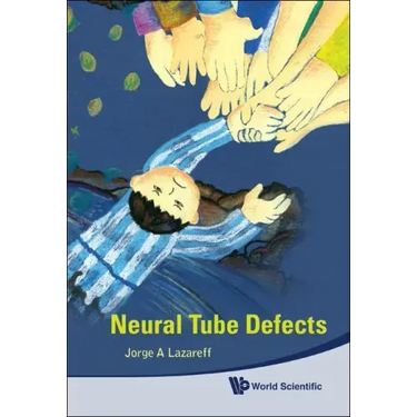 Neural Tube Defects