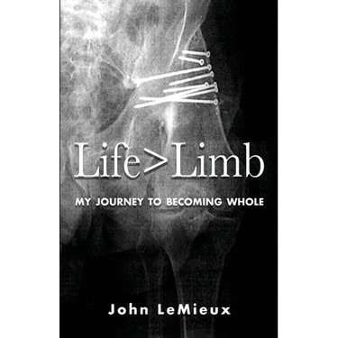 Life is Greater Than Limb: My Journey to Becoming Whole