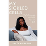My Sickled Cells