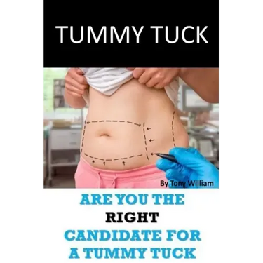 Tummy Tuck: Are You The Right Candidate For A Tummy Tuck