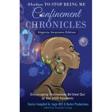 #Irefuse to Stop Being Me: Confinement Chronicles - Alopecia Awareness Edition