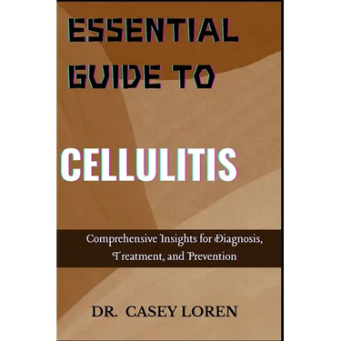 Essential Guide to Cellulitis: Comprehensive Insights for Diagnosis, Treatment, and Prevention