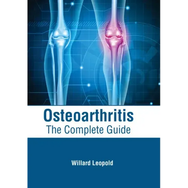 Osteoarthritis: The Complete Guide