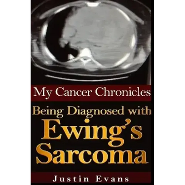 My Cancer Chronicles: Being Diagnosed with Ewing's Sarcoma