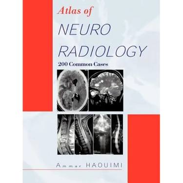 Atlas of Neuroradiology: 200 Common Cases