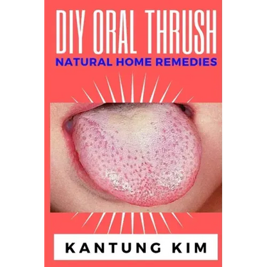 DIY Oral Thrush Natural Home Remedies: The Effective Step By Step Guide To Permanently End Oral Thrush