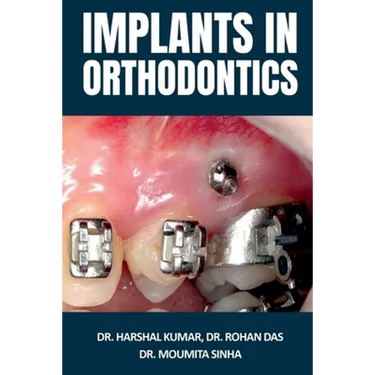 Implants in Orthodontics