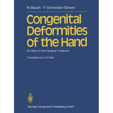 Congenital Deformities of the Hand: An Atlas of Their Surgical Treatment