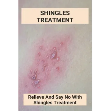 Shingles Treatment: Relieve And Say No With Shingles Treatment: Shingles On Face Treatment
