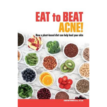 Eat to Beat Acne!: How a plant-based diet can help heal your skin.