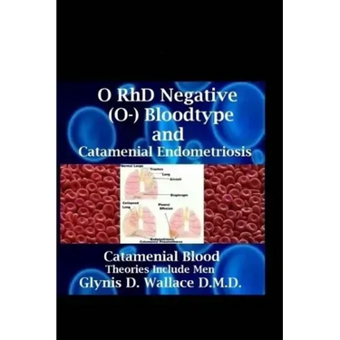 O RhD Negative (O-) Bloodtype And Catamenial Endometriosis: Catamenial Blood Theories Include Men