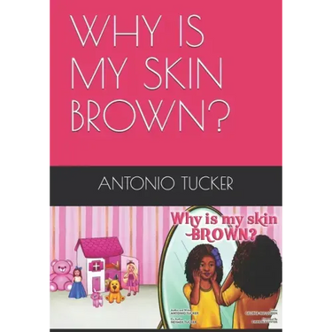 Why Is My Skin Brown?
