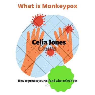 What Is Monkeypox: How to protect yourself and what to look out for. Guidelines for safety