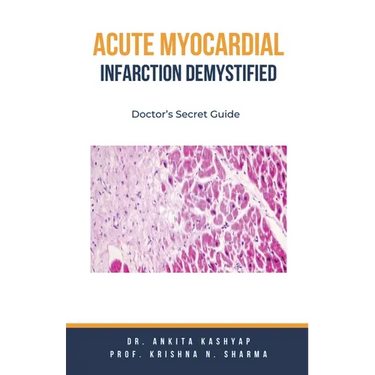 Acute Myocardial Infarction Demystified: Doctor's Secret Guide