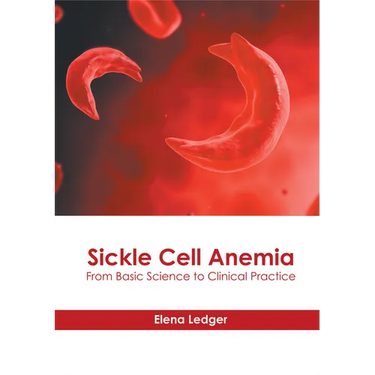 Sickle Cell Anemia: From Basic Science to Clinical Practice