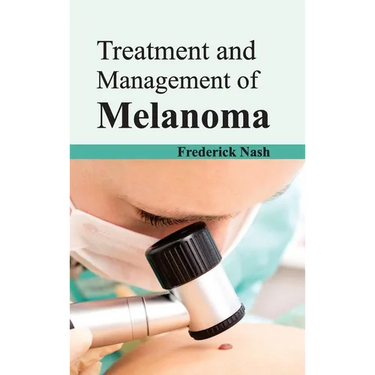 Treatment and Management of Melanoma