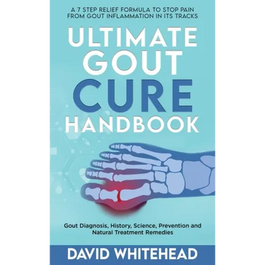 Ultimate Gout Cure Handbook: Gout Diagnosis, History, Science, Prevention and Natural Treatment Remedies