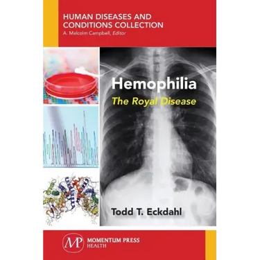 Hemophilia: The Royal Disease