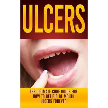 Ulcers: The Ultimate Cure Guide for How to Get Rid of Mouth Ulcers Instantly