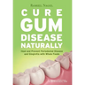 Cure Gum Disease Naturally: Heal Gingivitis and Periodontal Disease with Whole Foods