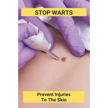 Stop Warts: Prevent Injuries To The Skin: Warts Treatment Near Me