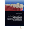 Implant Supported Fixed Partial Dentures