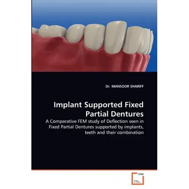 Implant Supported Fixed Partial Dentures
