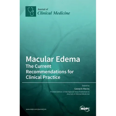 Macular Edema: The Current Recommendations for Clinical Practice