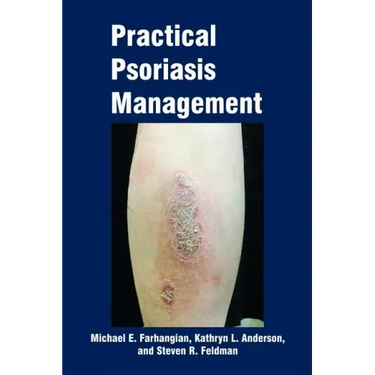 Practical Psoriasis Management