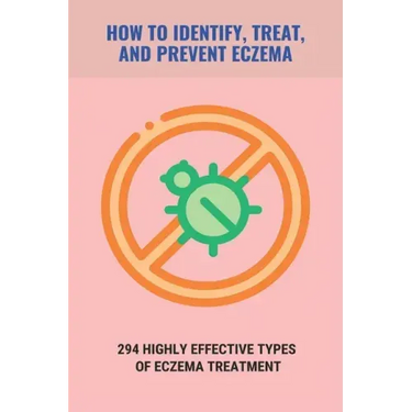 How To Identify, Treat, And Prevent Eczema: 294 Highly Effective Types Of Eczema Treatment: How To Cure Eczema Fast