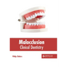 Malocclusion: Clinical Dentistry