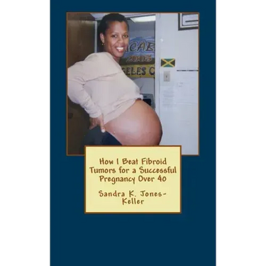 How I Beat Fibroid Tumors for a Successful Pregnancy Over 40
