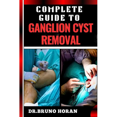 Complete Guide to Ganglion Cyst Removal: Comprehensive Handbook To Expert Techniques, Home Remedies, And Post Surgery Care For Pain Relief And Healing