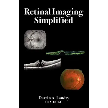 Retinal Imaging Simplified