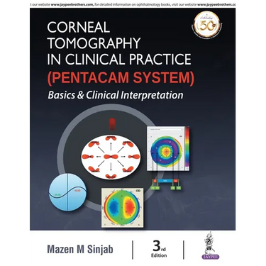 Corneal Tomography in Clinical Practice (Pentacam System): Basics and Clinical Interpretation