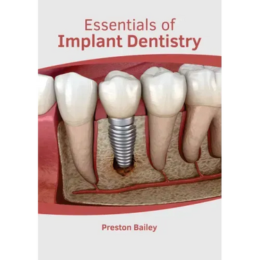 Essentials of Implant Dentistry
