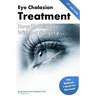 Eye Chalazion: How To Remove Without Surgery: My personal experience and the methods I used for success
