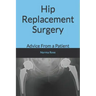 Hip Replacement Surgery: Advice From a Patient