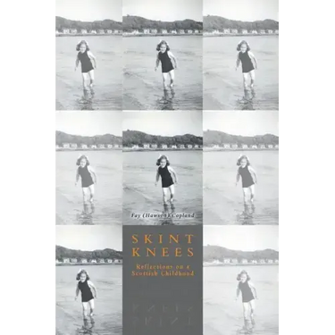 Skint Knees: Reflections on a Scottish Childhood