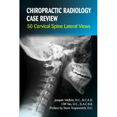 Chiropractic Radiology Case Review: 50 Cervical Spine Lateral Views