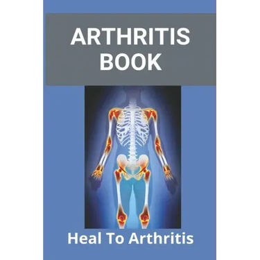 Arthritis Book: Heal To Arthritis: Rheumatoid Arthritis Treatment
