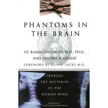 Phantoms in the Brain
