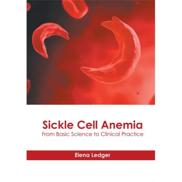 Sickle Cell Anemia: From Basic Science to Clinical Practice