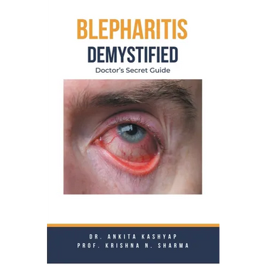 Blepharitis Demystified: Doctor's Secret Guide