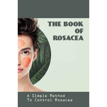 The Book Of Rosacea- A Simple Method To Control Rosacea: Rosacea Treatment For Face