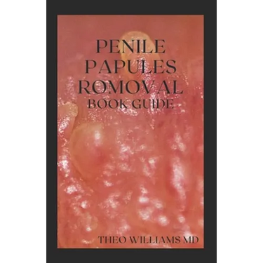 Penile Papules Romoval Book Guide: The Ultimate Guide On How To Remove Pearly Penile Papules Using Natural Remedies