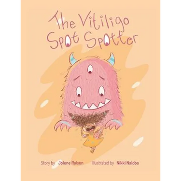 The Vitiligo Spot Spotter