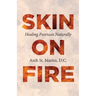 Skin on Fire: Healing Psoriasis Naturally
